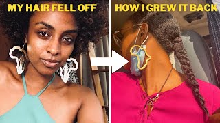 My Natural Hair Journey | Losing My Hair, Growing It Back, Hair Secrets I'Ve Learned [ With Pho