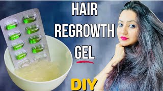 Diy Hair Regrowth Gel For Extreme Hair Growth | Baalon Ko Phir Se Ugaane Ke Lie Ghr Pr Bnaaye Diy Ge