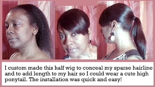 I Made This Ponytail Hair Unit To Conceal Alopecia Around My Front Hairline To Make My Hair Longer