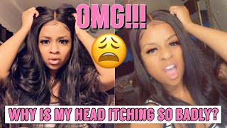 How To: Prevent/ Get Your Sew In From Itching Using Natural Ingredients | **Must Watch** |