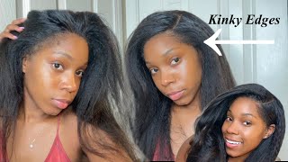 How To: Super Natural Hairline | Ilikehair