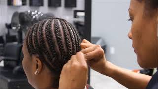 Seborrheic Dermatitis Sew In Weave Education And  Hair Tips