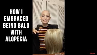 How I Embraced Being Bald With Alopecia