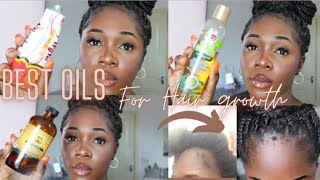 3 Best Oils For Massive Hair Growth \ Best Oil For Dandruff \ Grows Edges ,Long And Thick Hair