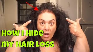How To Hide Hair Loss With No Track Magic Clip Ins.. Free Shipping