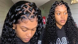 Scalp. The Best Lace I'Ve Seen! Ft. Omgherhair