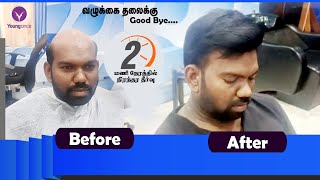Hair Replacement| Hair Fixing | Hair Wig | Nagercoil | Salem | Coimbatore | 97517 68734,  8110072863
