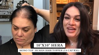 Non-Clip Hair Topper | No Need To Worry About Clips Now! | Large Base For Hair Loss