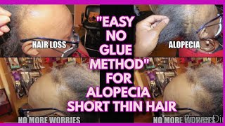 Sew-In Weave For Alopecia And Thinning Tutorial