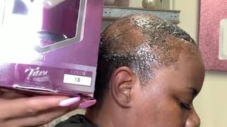 Quick Weave Slay On Alopecia