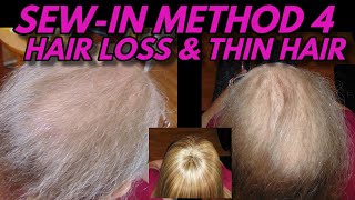 Sew-In Weave Method For Hair Loss & Thin Hair After Cancer & Chemo