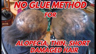 No Glue Sew-In Weave Method For Alopecia, Short, Thin Or Damaged Hair