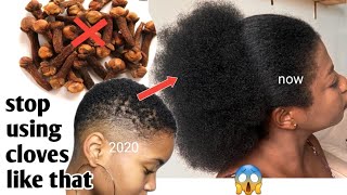 Cloves Stop Working For You Because You'Re Using It Wrongly/Use This & Ur Hair Will Grow Like C