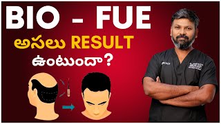 #Askdrjohnwatts | Frequently Asked Questions (Faq'S) | Best Hair Specialist In Hyderabad Explai