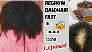 No Jokes! Mixed Cloves&Ginger, Indian Secret To Speed Up Hairgrowth And Treat Baldness