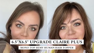How To Lower Your Hairline: Lace Front Topper Helps You!  | Hair Topper Review