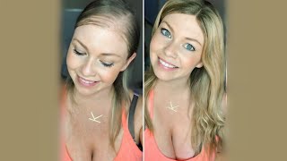 Reviewing A Lace Front Hair Topper For Thinning Hair| 3/4 Cap Wig