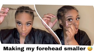 Big Forehead Hack  Using A Hd Frontal