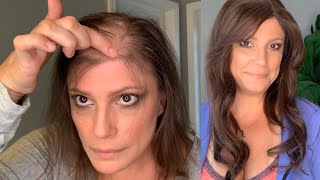 Hair Topper101| Carefree Coverage With Human Hair Topper