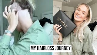 Hair Topper Review| A Super Natural Hair Topper| Hair Loss Journey