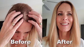 Hair Topper 101| How To Use Bio Hair To Make A Hair Topper Look More Natural