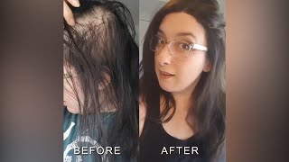 Hair Topper Review| Hope Sythetic Mono Topper For Thinning Crown