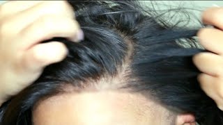 How To: Lace Frontal Sew In No Glue No Tape No Leave Out