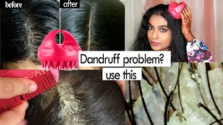 Get Rid Of Dandruff Flakes Using This Shampoo Brush | Remove White Flakes  Easily