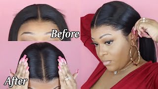 All You Need To Know: Lay Your Lace Wig Flat & Make It Grow From Scalp | Hairvivi