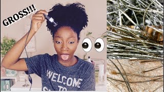 Magnified Natural Hair And Scalp! | Loc Method Under A Microscope | Wet, Oily, Conditioned Hair Etc