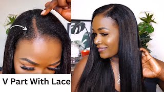 Omg Scalp | Invisible V Part With Lace | Game Changer | Flawless Blending | Myfirstwig