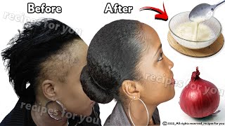 Onion Juice For Extreme Hair Growth! Stop Hair Loss And Grow Long Hair