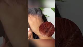 Wig Contrast For Beginners | Choose Lace Frontal Wig With Clean Bleached Knots | Get A Flawless Look