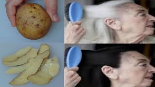 Gray Hair Turn To Black Hair Naturally With Potato Peel \\ Get Rid Gray Hair Naturally In 6 Minute