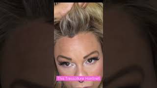 This Hairline!! Tressallure Spectacular Shag