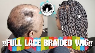 Lupus (Sle) Survivor | Alopecia | Hairloss | Full Lace Braided Wig | Manetamed