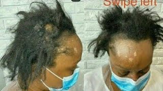 She Had Weave In For 6 Months & Her Hair Started To Mat, Go Checkout Her Gorgeous Transformation