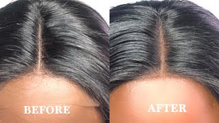 How To Make Your Closure Part Looks Natural For Beginners