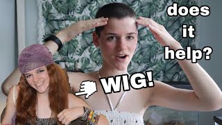 Do Wigs Or Hair Extensions Help You Stop Pulling? | Trichotillomania