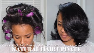 Natural Hair Update: I Have Seborrheic Dermatitis + How To Do A Roller Set For Extra Volume