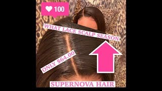 Best 6X6 Closure Ever (Pre-Plucked) (No Balding)Get The Frontal Look