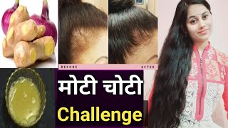 30 Days Extreme Hair Growth Challenge : Use This Hair Growth Tonic For Triple Hair Growth & Density