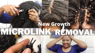 Extremely Detailed How To Remove Microlink Hair Extensions | Microbeads