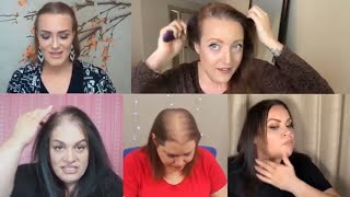 Uniwigs Saved My Life-My Hair Loss Journey