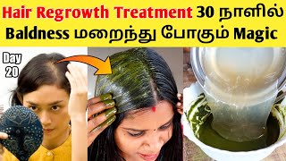  30 Naallil Baldness Mrraintu Pookum Magic Hair Regrowth Treatment / 30 Days Challenge / Hair Pack 7