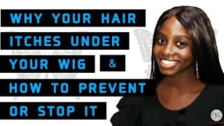 How To Stop Itchy Hair Under Wigs In 2022 | How To Stop Itchy Scalp 2022 (+ Free Prevention Tips)