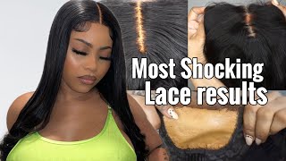 How To Hide Your Lace Holes | Giving Scalp | Ft Dola Hair