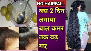 My Mom Turned Her Thin Hair To Thick Hair In 30 Days - Amla Hair Oil For Hair Growth & Long Hair