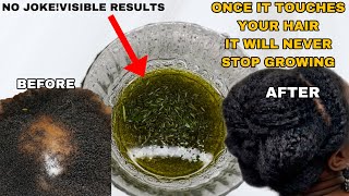 You Haven'T Tried This Yet,Reason Why Ya Hair Isn'T Growing!How I Grew My Hair With Diy Ro