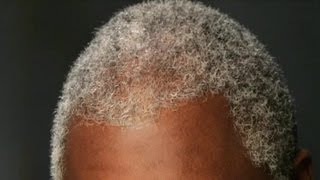How To Care For Gray Hair In African-Americans : Health Advice